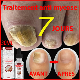 Traitement anti mycose pour ongles -  Livraison offerte