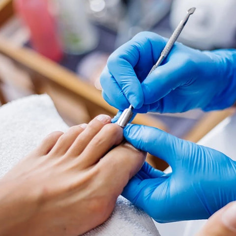 Kit pour ongles incarnés - Livraison offerte
